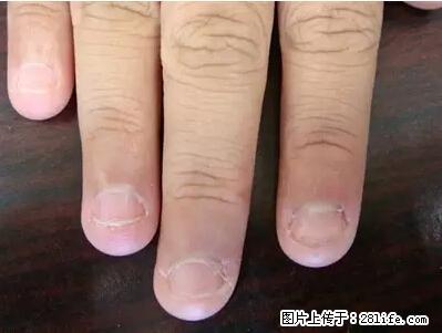 剪指甲、挖耳屎，这些日常小动作竟隐藏大危害！ - 资阳生活资讯 - 资阳28生活网 zy.28life.net
